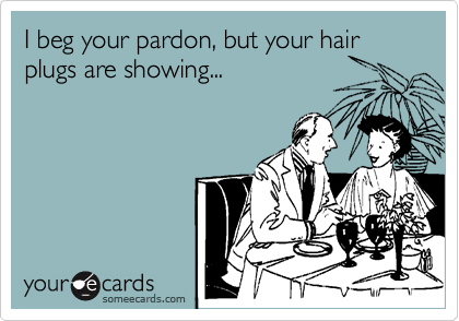 I beg your pardon, but your hair plugs are showing...