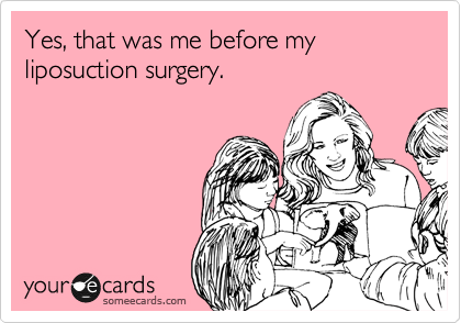 Yes, that was me before my liposuction surgery.