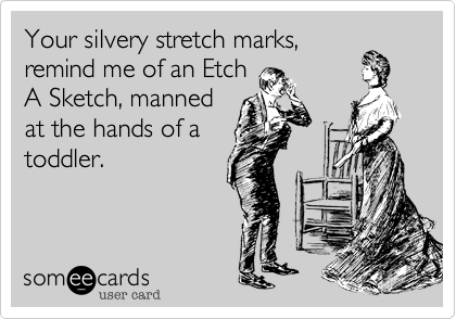Your silvery stretch marks,
remind me of an Etch
A Sketch, manned 
at the hands of a
toddler.