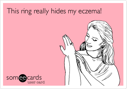 This ring really hides my eczema!