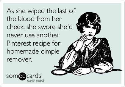As she wiped the last of
the blood from her
cheek, she swore she'd
never use another
Pinterest recipe for
homemade dimple
remover.