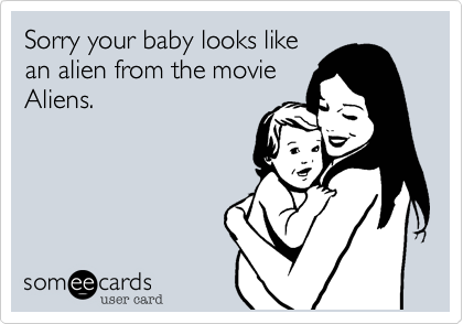 Sorry your baby looks likean alien from the movieAliens.