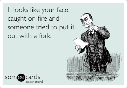 It looks like your face
caught on fire and
someone tried to put it
out with a fork.