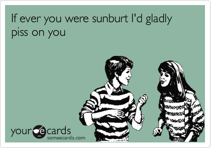 If ever you were sunburt I'd gladly piss on you