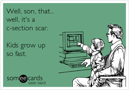 Well, son, that...
well, it's a
c-section scar.

Kids grow up
so fast.