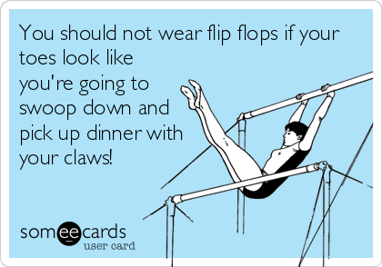 You should not wear flip flops if your
toes look like
you're going to
swoop down and
pick up dinner with
your claws!