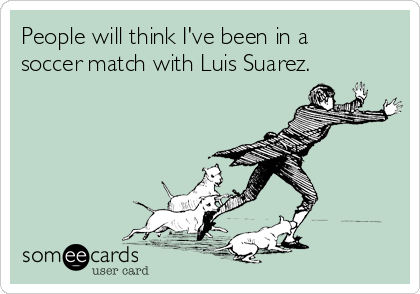 People will think I've been in a
soccer match with Luis Suarez.